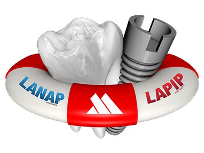 laser dentistry for periodontal disease around dental implants
