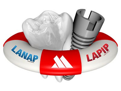 laser dentistry for periodontal disease around dental implants